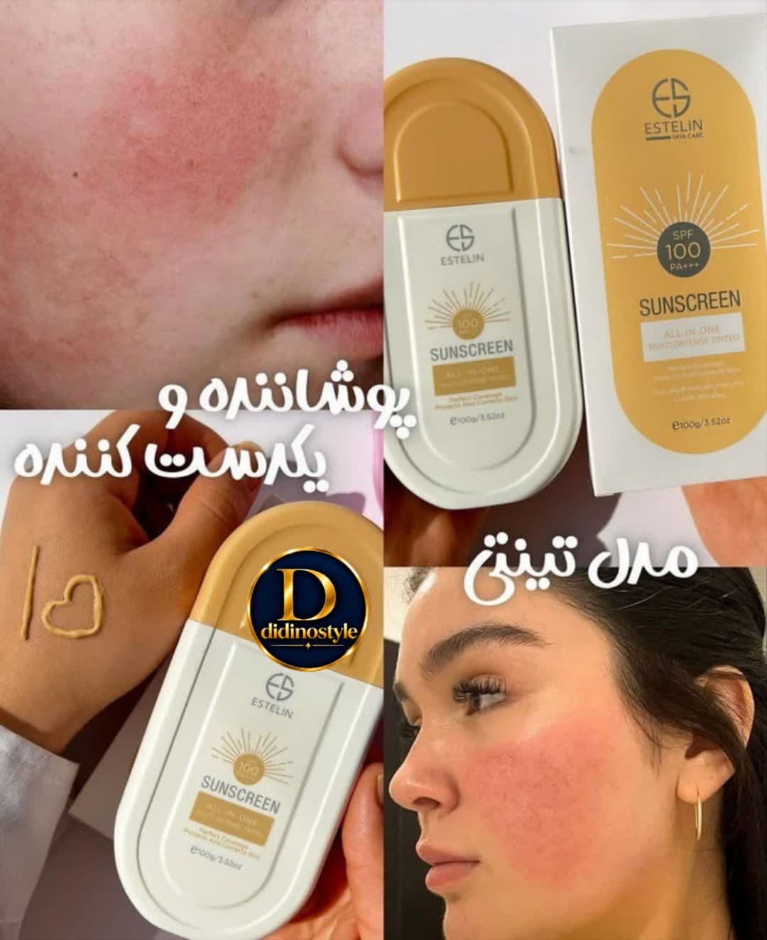 ضد آفتاب  گرمی استیلن - 6